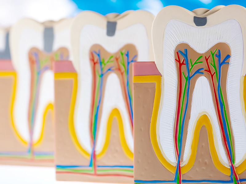 根管治療