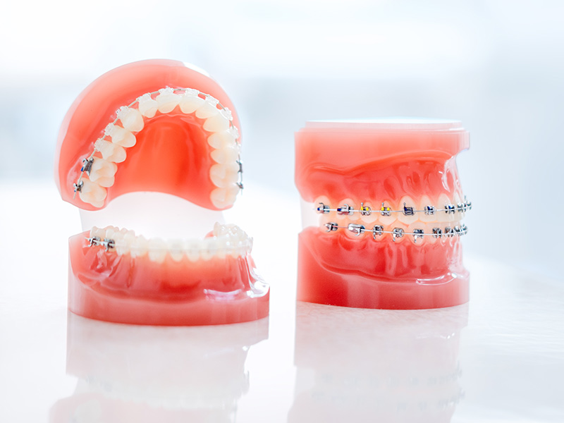 矯正歯科・小児矯正歯科