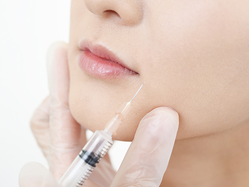 歯科ボツリヌス治療